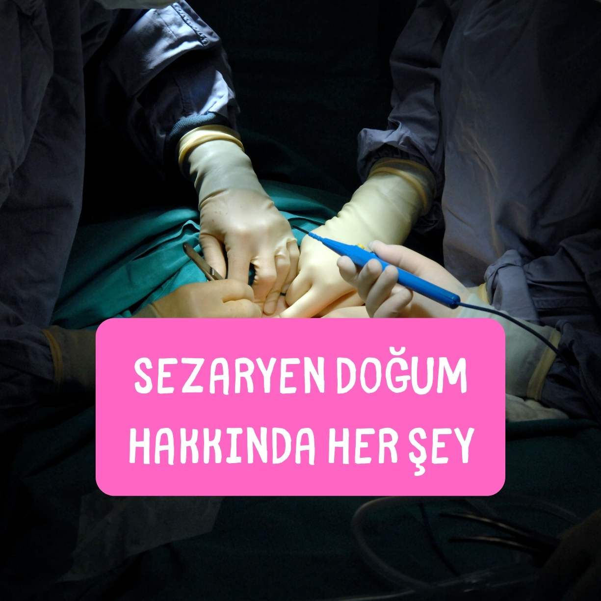 sezaryen dogum hakkında herşey