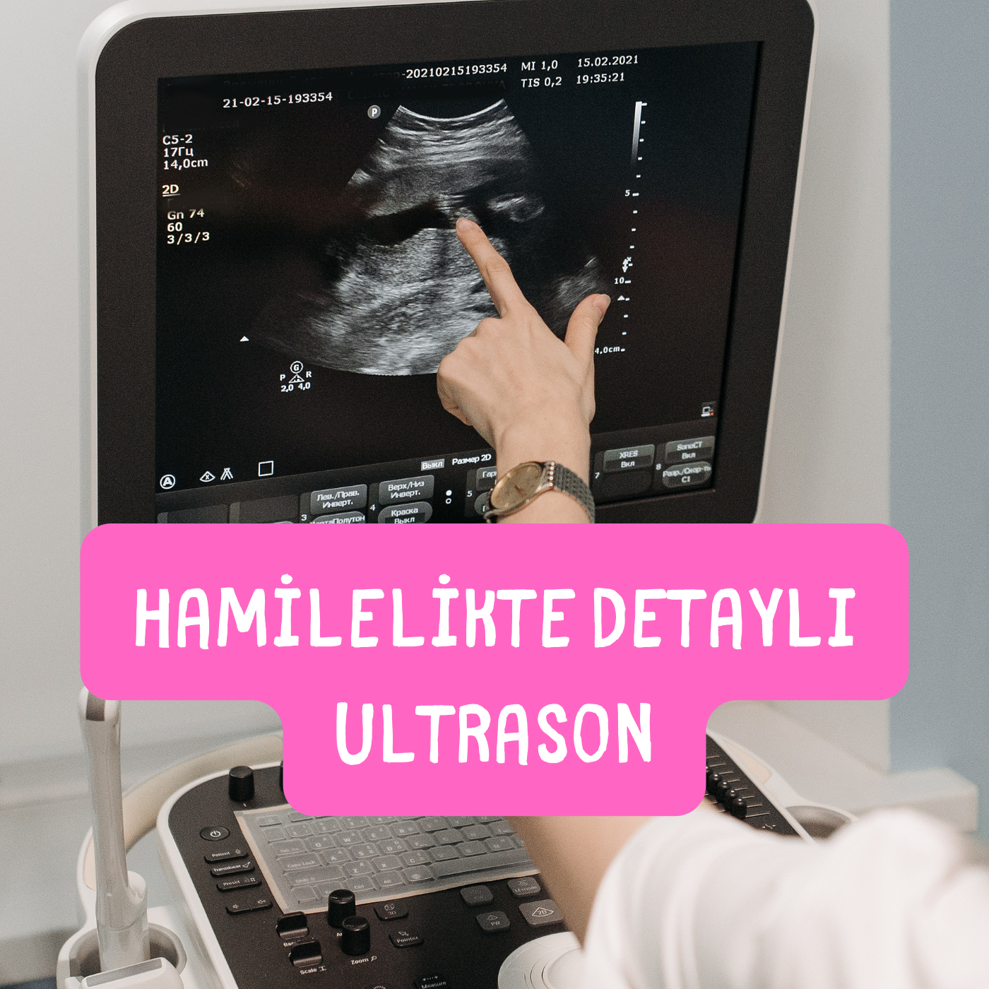 hamilelikte detaylı ultrason